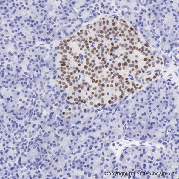 Immunohistochemistry (Formalin/PFA-fixed paraffin-embedded sections) - Anti-PAX6 antibody [AD2.38] (AB78545), expandable thumbnail