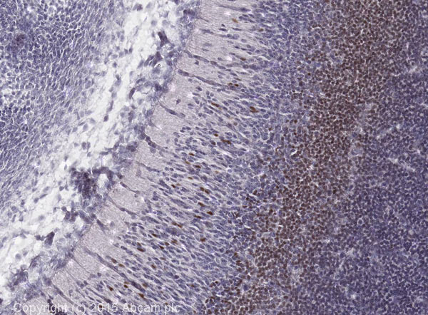 Immunohistochemistry (Formalin/PFA-fixed paraffin-embedded sections) - Anti-PAX6 antibody [AD2.38] (AB78545), expandable thumbnail