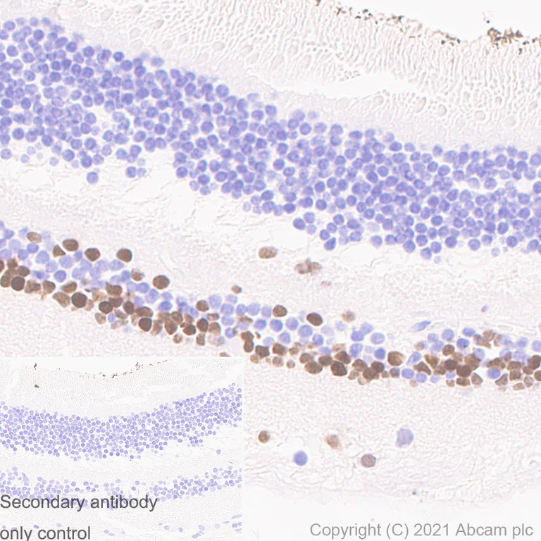Immunohistochemistry (Formalin/PFA-fixed paraffin-embedded sections) - Anti-PAX6 antibody [AD2.38] (AB78545)