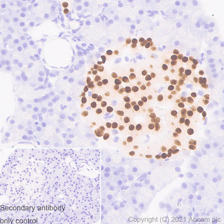 Immunohistochemistry (Formalin/PFA-fixed paraffin-embedded sections) - Anti-PAX6 antibody [AD2.38] (AB78545)