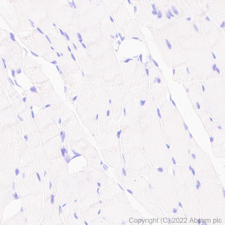 Immunohistochemistry (Formalin/PFA-fixed paraffin-embedded sections) - Anti-PAX6 antibody [AD2.38] - BSA and Azide free (AB307680)