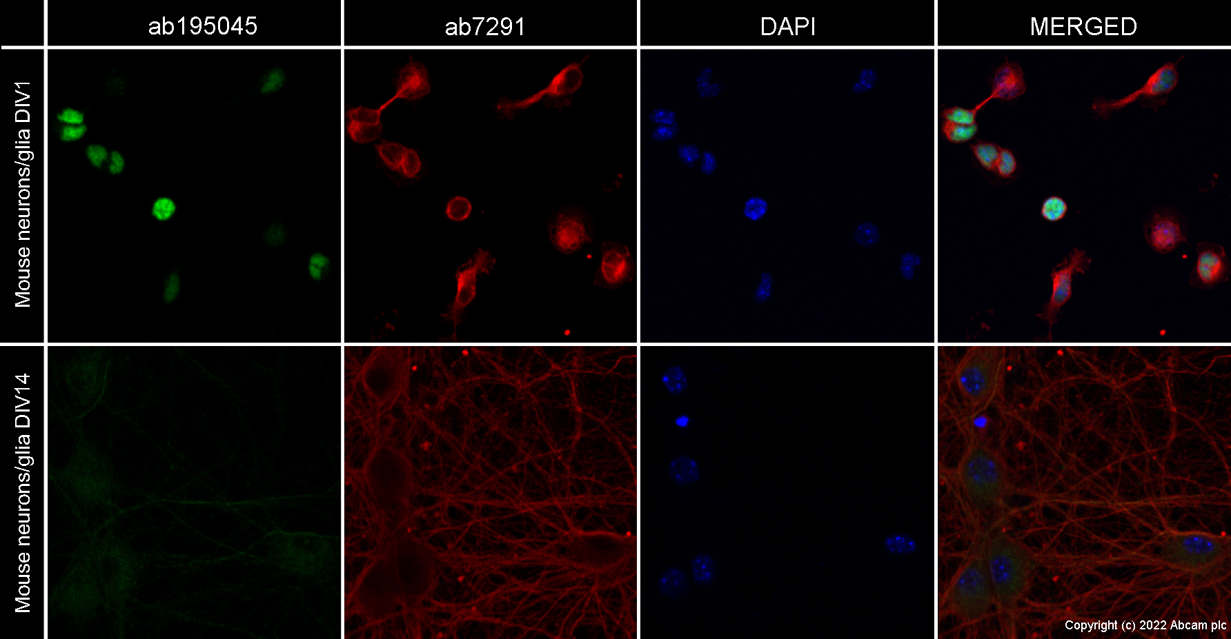 Immunocytochemistry/ Immunofluorescence - Anti-PAX6 antibody [EPR15858] (ab195045), expandable thumbnail