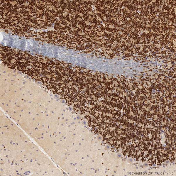 Immunohistochemistry (Formalin/PFA-fixed paraffin-embedded sections) - Anti-PAX6 antibody [EPR15858] (ab195045), expandable thumbnail