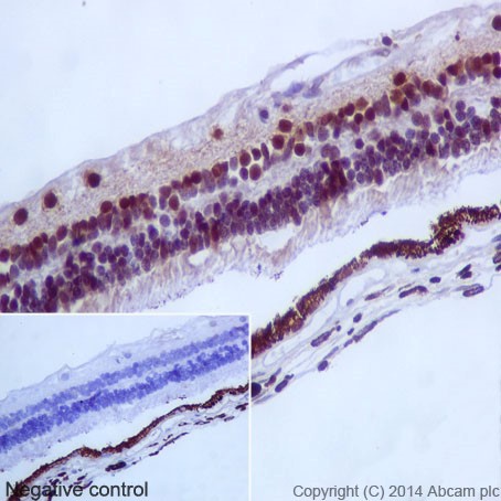 Immunohistochemistry (Formalin/PFA-fixed paraffin-embedded sections) - Anti-PAX6 antibody [EPR15858] (AB195045), expandable thumbnail