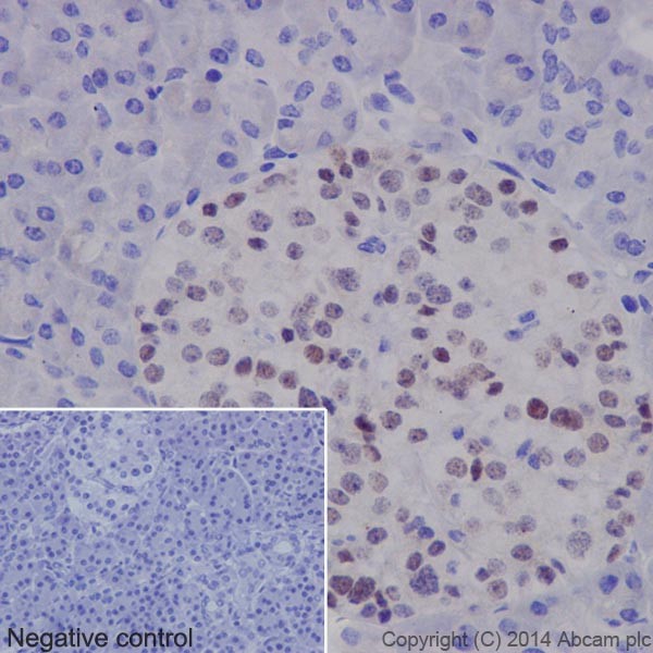Immunohistochemistry (Formalin/PFA-fixed paraffin-embedded sections) - Anti-PAX6 antibody [EPR15858] (ab195045), expandable thumbnail