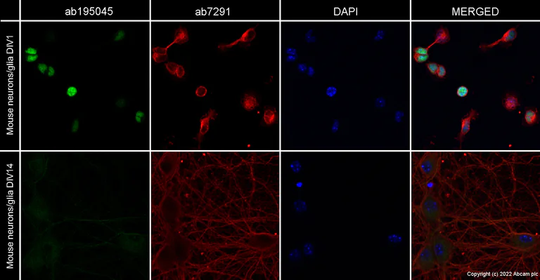 Immunocytochemistry/ Immunofluorescence - Anti-PAX6 antibody [EPR15858] - BSA and Azide free (AB233027)