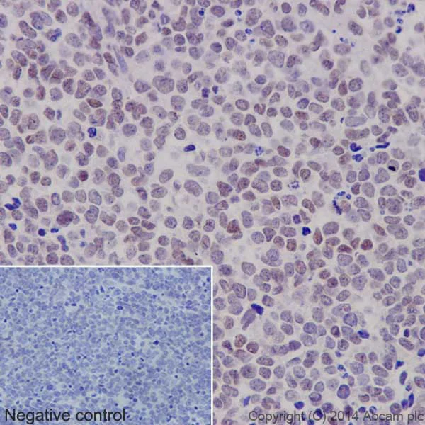 Immunohistochemistry (Formalin/PFA-fixed paraffin-embedded sections) - Anti-PAX6 antibody [EPR15858] - BSA and Azide free (AB233027)