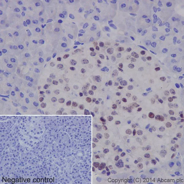 Immunohistochemistry (Formalin/PFA-fixed paraffin-embedded sections) - Anti-PAX6 antibody [EPR15858] - BSA and Azide free (AB233027)