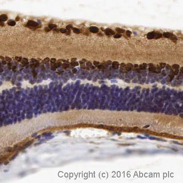 Immunohistochemistry (Formalin/PFA-fixed paraffin-embedded sections) - Anti-PAX6 antibody [EPR3352(2)] (AB109233)
