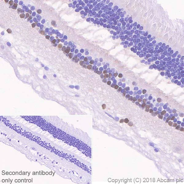 Immunohistochemistry (Formalin/PFA-fixed paraffin-embedded sections) - Anti-PAX6 antibody [EPR3352(2)] (AB109233)