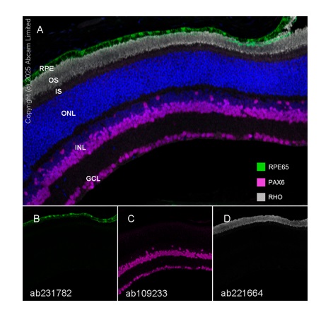 Anti-PAX6 antibody [EPR3352(2)]