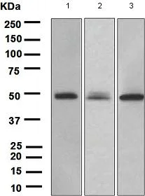 Western blot - Anti-PAX6 antibody [EPR3352(2)] (AB109233)