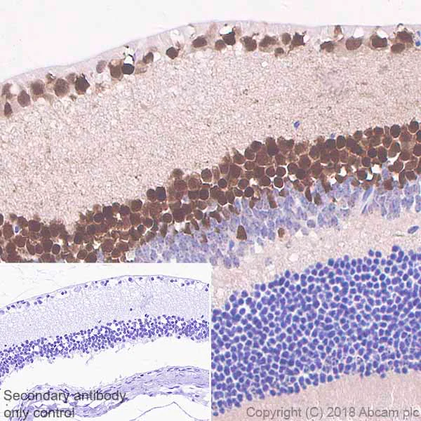 Immunohistochemistry (Formalin/PFA-fixed paraffin-embedded sections) - Anti-PAX6 antibody [EPR3352(2)] - BSA and Azide free (AB238149)