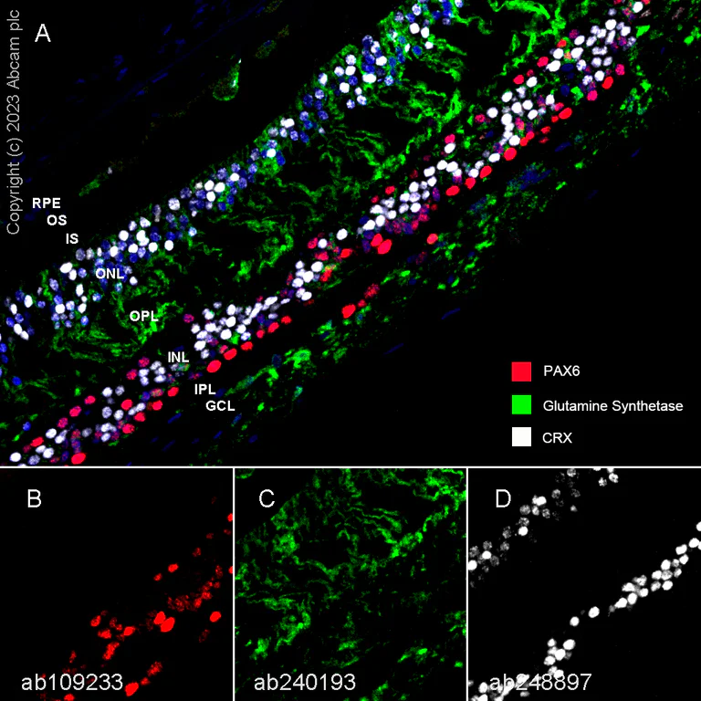 Multiplex immunohistochemistry - Anti-PAX6 antibody [EPR3352(2)] - BSA and Azide free (AB238149)