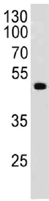 Western blot - Anti-PAX6 antibody [PAX6/498] - BSA and Azide free (AB212694)