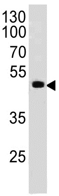 Western blot - Anti-PAX6 antibody [PAX6496] (AB197768)