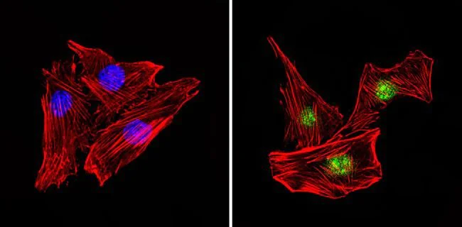 Immunocytochemistry/ Immunofluorescence - Anti-PAX7 antibody (AB187339)