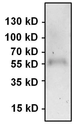 Immunoprecipitation - Anti-PAX7 antibody (AB187339)