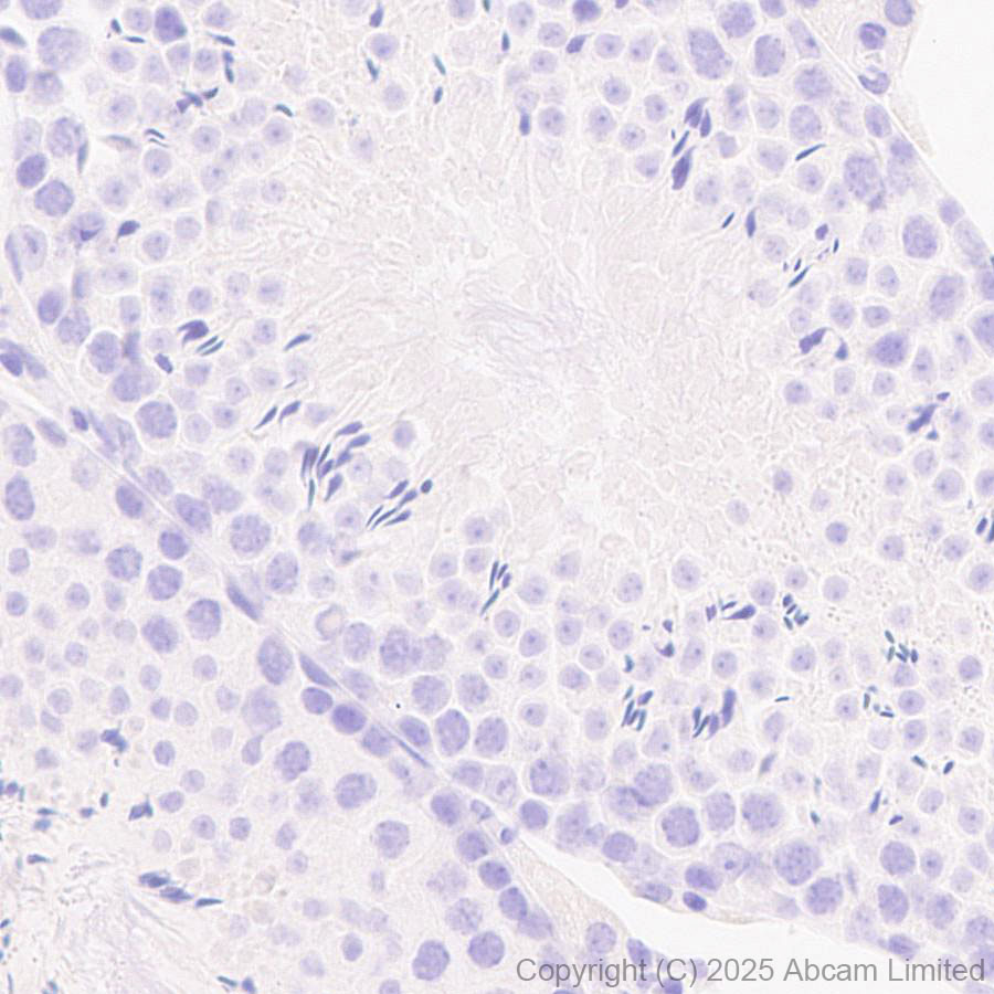 Immunohistochemistry (Formalin/PFA-fixed paraffin-embedded sections) - Anti-PAX7 antibody [EPR30466-531] (ab324017), expandable thumbnail