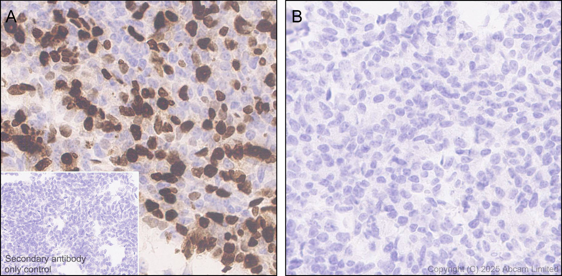 Immunohistochemistry (Formalin/PFA-fixed paraffin-embedded sections) - Anti-PAX7 antibody [EPR30466-531] (ab324017), expandable thumbnail