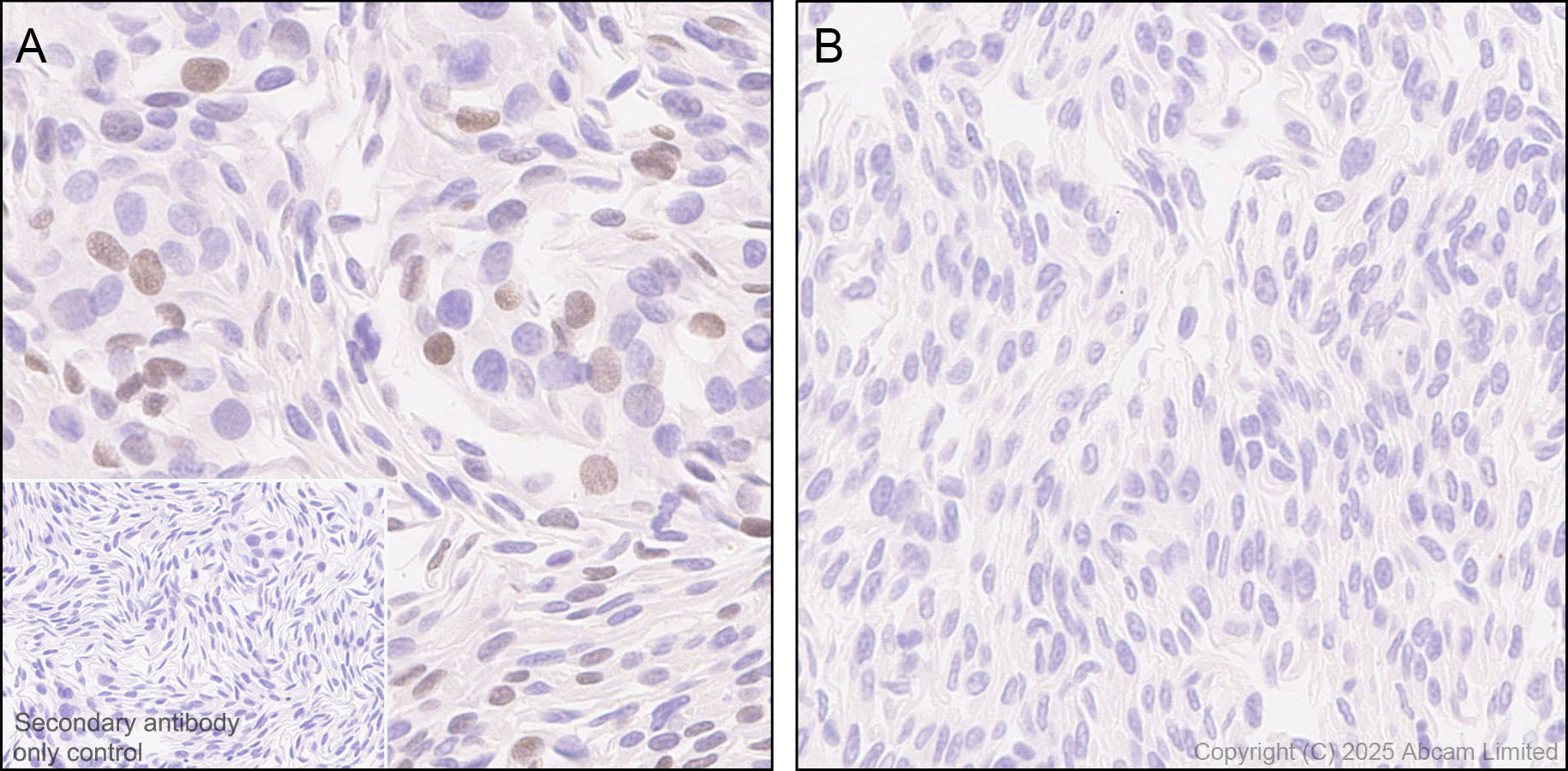 Immunohistochemistry (Formalin/PFA-fixed paraffin-embedded sections) - Anti-PAX7 antibody [EPR30466-531] (ab324017), expandable thumbnail