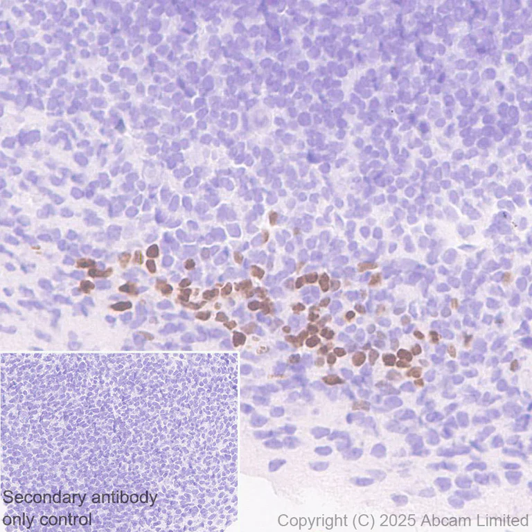 Immunohistochemistry (Formalin/PFA-fixed paraffin-embedded sections) - Anti-PAX7 antibody [EPR30466-531] - BSA and Azide free (AB324018)