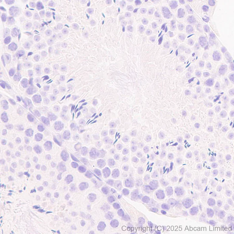 Immunohistochemistry (Formalin/PFA-fixed paraffin-embedded sections) - Anti-PAX7 antibody [EPR30466-531] - BSA and Azide free (AB324018)