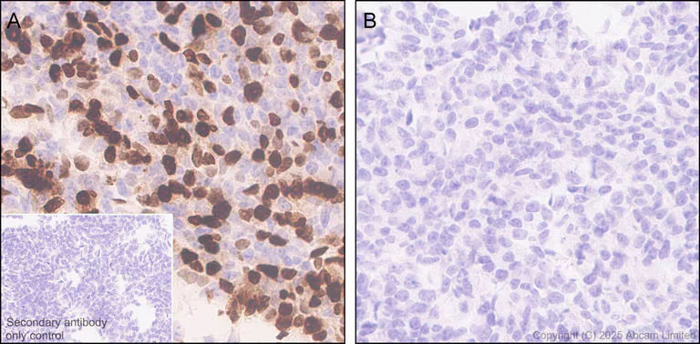 Immunohistochemistry (Formalin/PFA-fixed paraffin-embedded sections) - Anti-PAX7 antibody [EPR30466-531] - BSA and Azide free (AB324018)