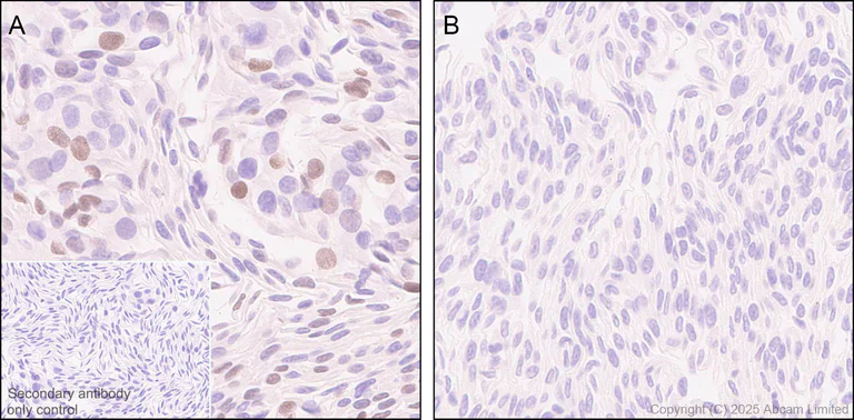 Immunohistochemistry (Formalin/PFA-fixed paraffin-embedded sections) - Anti-PAX7 antibody [EPR30466-531] - BSA and Azide free (AB324018)