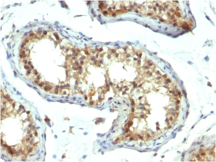 Immunohistochemistry (Formalin/PFA-fixed paraffin-embedded sections) - Anti-PAX7 antibody [PAX7/1187] (AB218472)