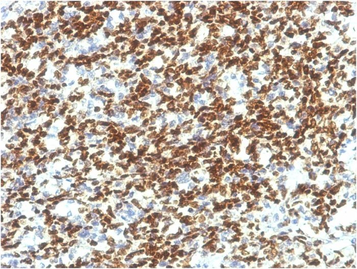 Immunohistochemistry (Formalin/PFA-fixed paraffin-embedded sections) - Anti-PAX7 antibody [PAX7/1187] (AB218472)