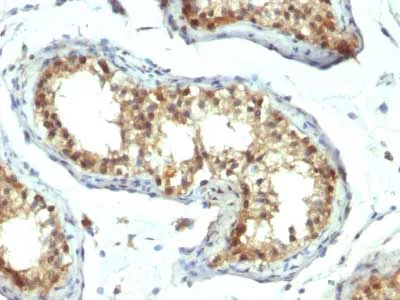 Immunohistochemistry (Formalin/PFA-fixed paraffin-embedded sections) - Anti-PAX7 antibody [PAX7/1187] - BSA and Azide free (AB215863)