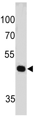 Western blot - Anti-PAX7 antibody [PAX7497] (AB199010), expandable thumbnail