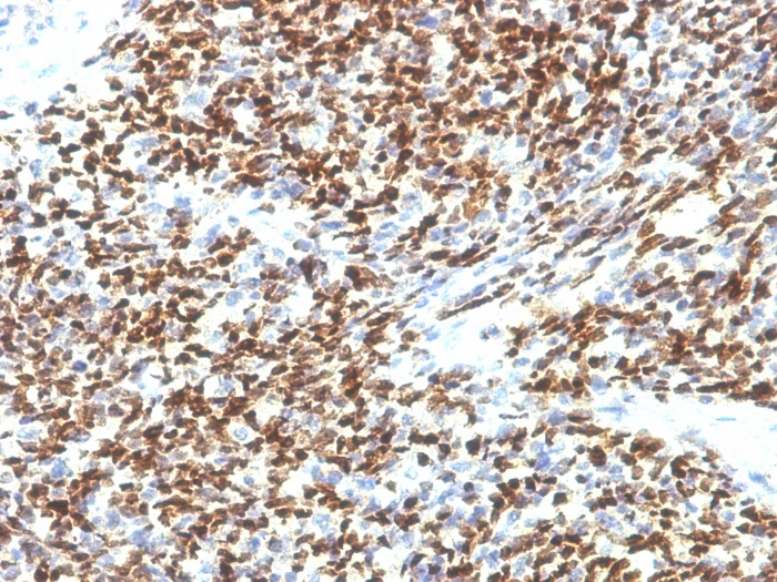 Immunohistochemistry (Formalin/PFA-fixed paraffin-embedded sections) - Anti-PAX7 antibody [SPM613] (AB218473)