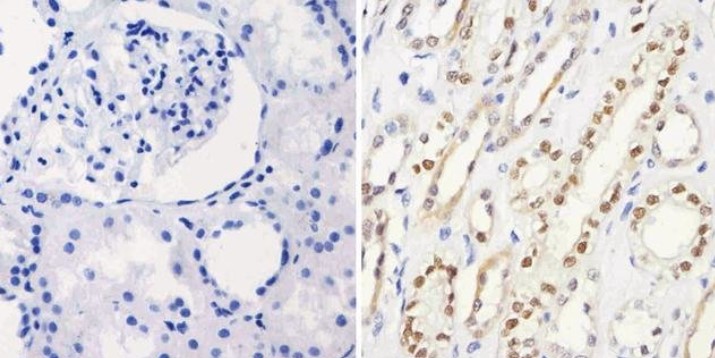 Immunohistochemistry (Formalin/PFA-fixed paraffin-embedded sections) - Anti-PAX8 antibody [1F8-3A8] (AB183573), expandable thumbnail