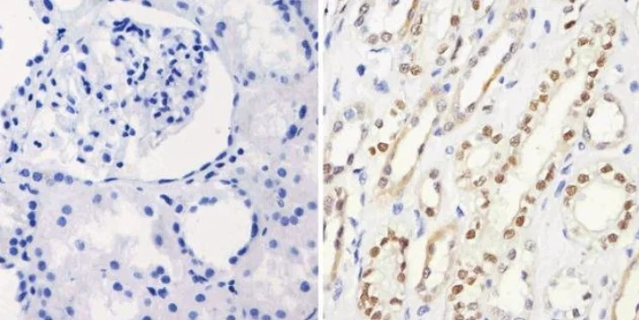 Immunohistochemistry (Formalin/PFA-fixed paraffin-embedded sections) - Anti-PAX8 antibody [1F8-3A8] (AB183573)