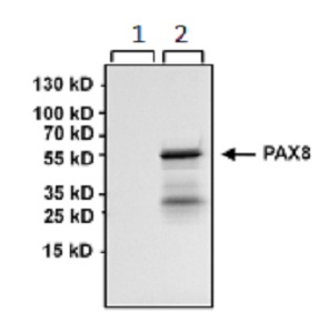 Western blot - Anti-PAX8 antibody [1F8-3A8] (AB183573), expandable thumbnail