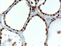 Immunohistochemistry (Formalin/PFA-fixed paraffin-embedded sections) - Anti-PAX8 antibody (AB13611)