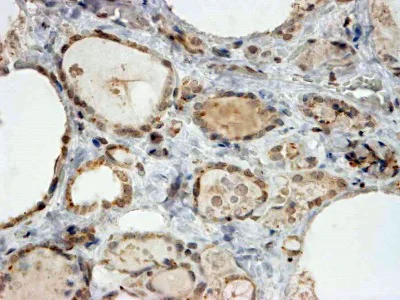 Immunohistochemistry (Formalin/PFA-fixed paraffin-embedded sections) - Anti-PAX8 antibody (AB13611)