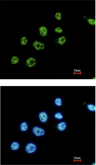Immunocytochemistry/ Immunofluorescence - Anti-PAX8 antibody (AB97477)