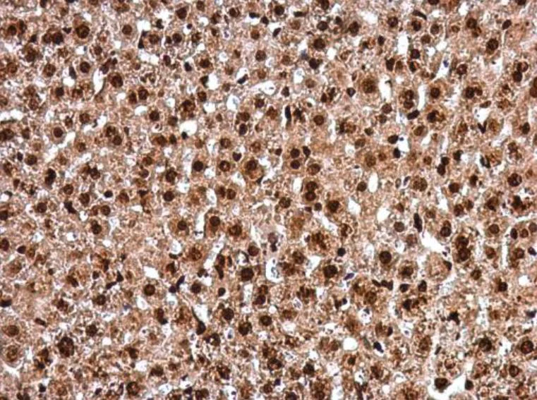Immunohistochemistry (Formalin/PFA-fixed paraffin-embedded sections) - Anti-PAX8 antibody (AB97477)