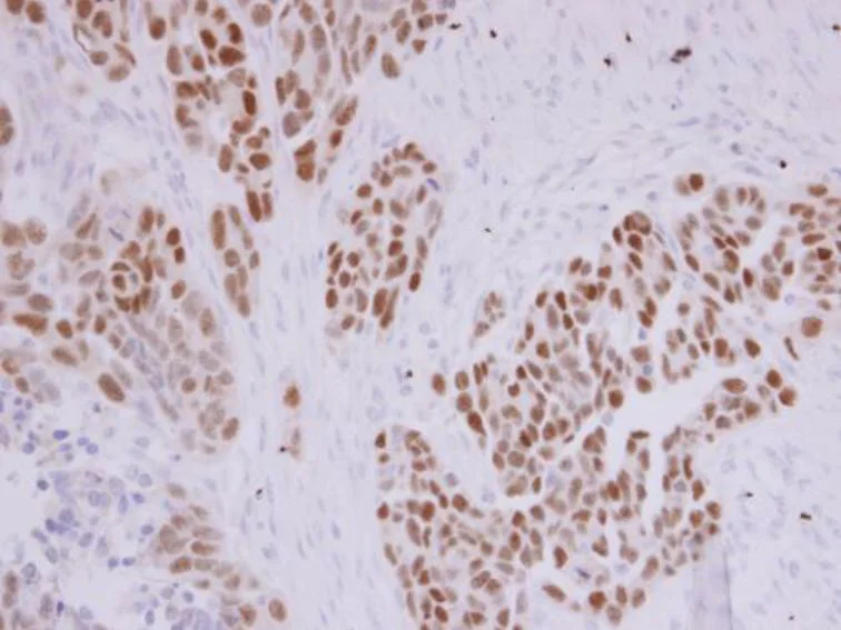 Immunohistochemistry (Formalin/PFA-fixed paraffin-embedded sections) - Anti-PAX8 antibody (AB97477)