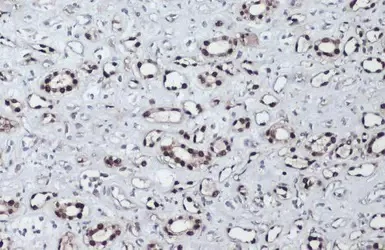 Immunohistochemistry (Formalin/PFA-fixed paraffin-embedded sections) - Anti-PAX8 antibody (AB97477)
