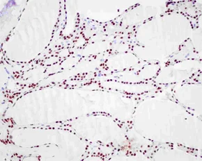 Immunohistochemistry (Formalin/PFA-fixed paraffin-embedded sections) - Anti-PAX8 antibody [EPR13510] (AB181054)