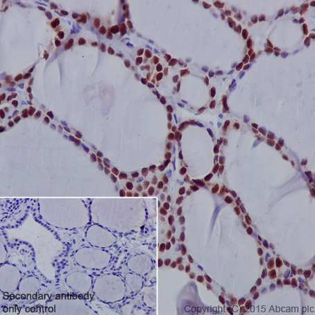 Immunohistochemistry (Formalin/PFA-fixed paraffin-embedded sections) - Anti-PAX8 antibody [EPR13510] (AB181054), expandable thumbnail