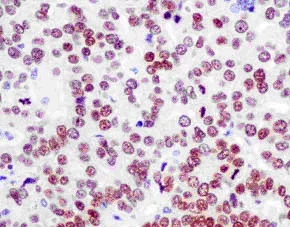Immunohistochemistry (Formalin/PFA-fixed paraffin-embedded sections) - Anti-PAX8 antibody [EPR13510] - BSA and Azide free (AB250312)