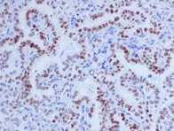 Immunohistochemistry (Formalin/PFA-fixed paraffin-embedded sections) - Anti-PAX8 antibody [EPR13511] - BSA and Azide free (AB240306)
