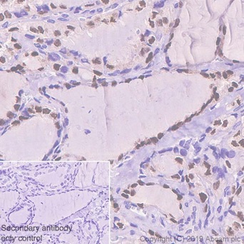 Immunohistochemistry (Formalin/PFA-fixed paraffin-embedded sections) - Anti-PAX8 antibody [EPR13511] - C-terminal (AB189249), expandable thumbnail
