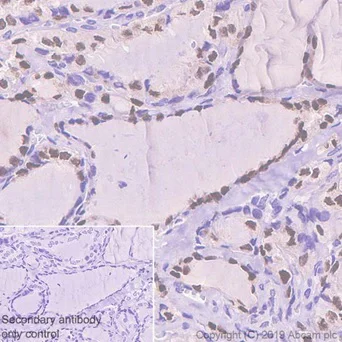Immunohistochemistry (Formalin/PFA-fixed paraffin-embedded sections) - Anti-PAX8 antibody [EPR13511] - C-terminal (AB189249)