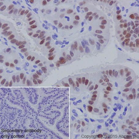 Immunohistochemistry (Formalin/PFA-fixed paraffin-embedded sections) - Anti-PAX8 antibody [EPR18715] (AB191870), expandable thumbnail